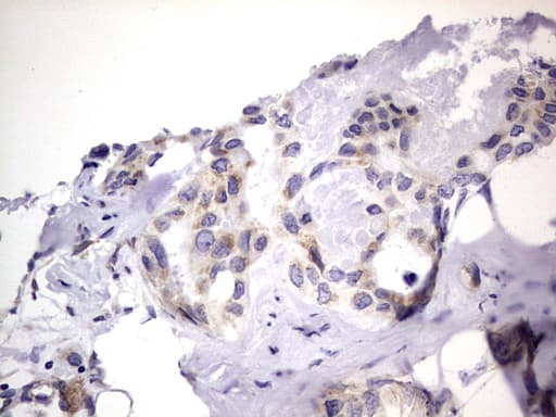 PRX-1 / PRRX1 Antibody (clone OTI1E10)