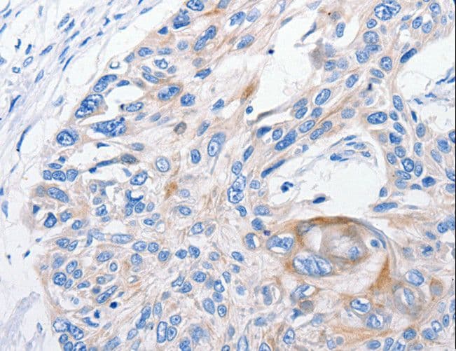 FANCF Antibody