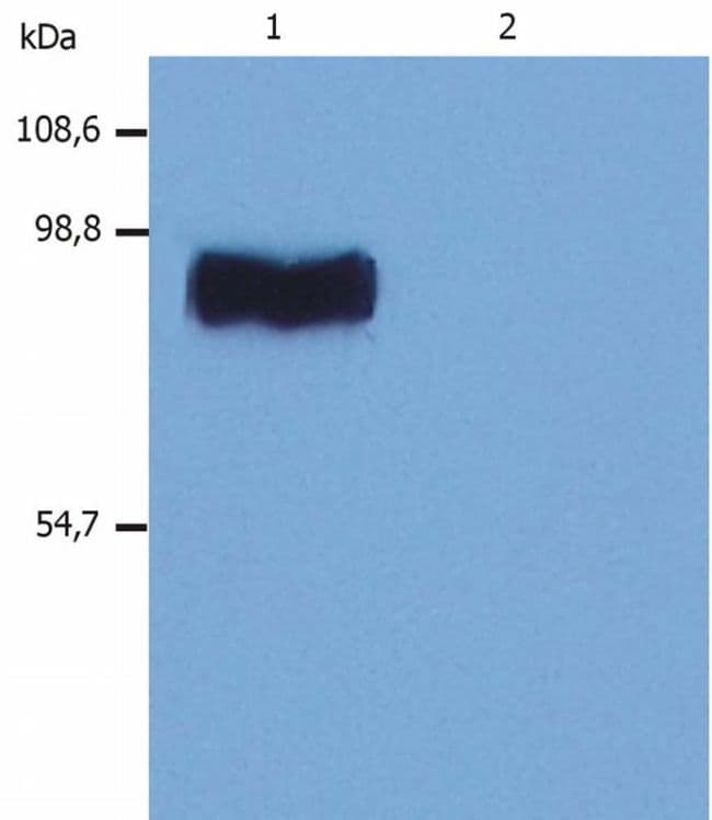 GOK / STIM1 Antibody (clone CDN3H4)