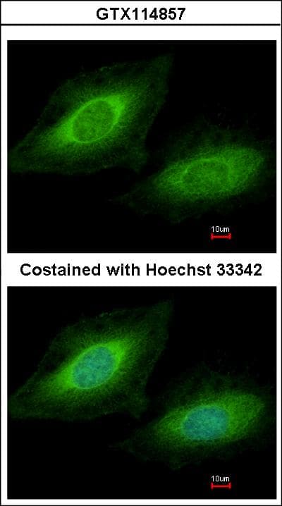 Polyclonal Rabbit anti-Human TSSC1 Antibody (aa1-192, WB)