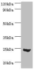 MAD2L1 / MAD2 Antibody (aa1-205)