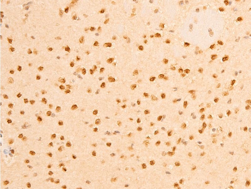 LMNA / Lamin A+C Antibody (phospho-Ser392)
