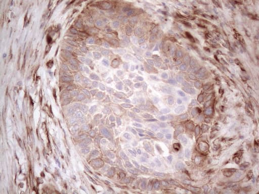LPIN1 / Lipin 1 Antibody (clone OTI7F5)