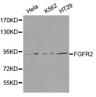 Polyclonal Rabbit anti-Human FGFR2 / FGF Receptor 2 Antibody (IHC, WB)