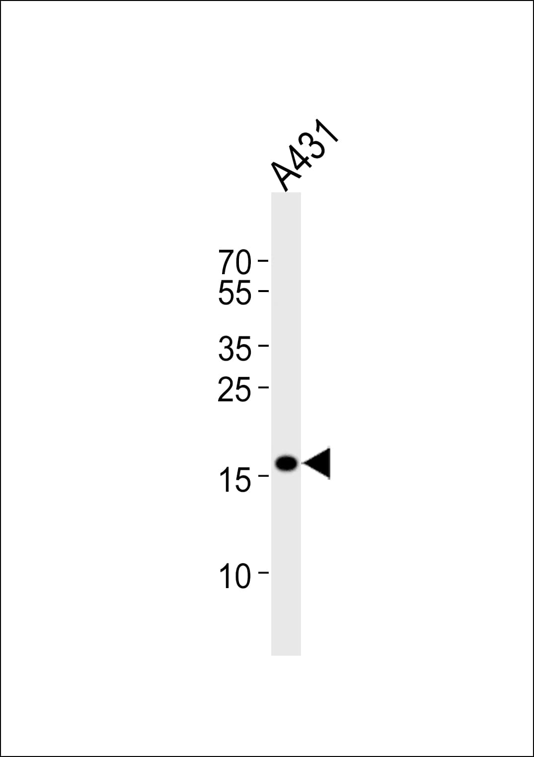 DUT / DUTPase Antibody (aa170-198)