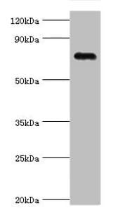 Polyclonal Rabbit anti-Human COMP / THBS5 Antibody (aa20-160, WB)