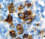 Monoclonal Mouse anti-Human CD38 Antibody (clone SPC32, Ready-to-Use, IHC)