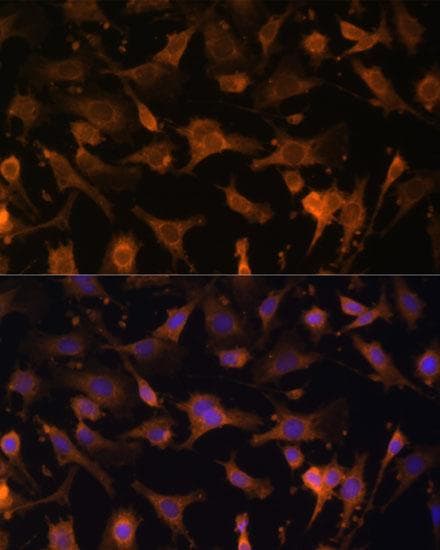 Polyclonal Rabbit anti-Human UFC1 Antibody (IF)