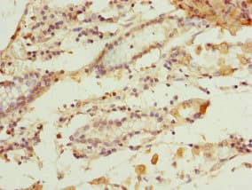 Polyclonal Rabbit anti-Human GSTZ1 Antibody (IHC)