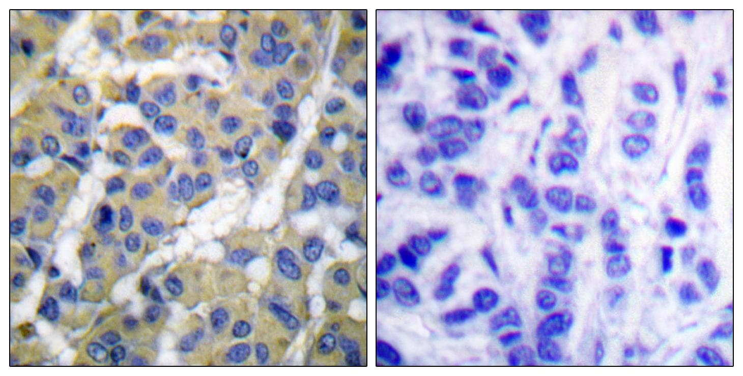KRT8 / CK8 / Cytokeratin 8 Antibody (phospho-Ser73)