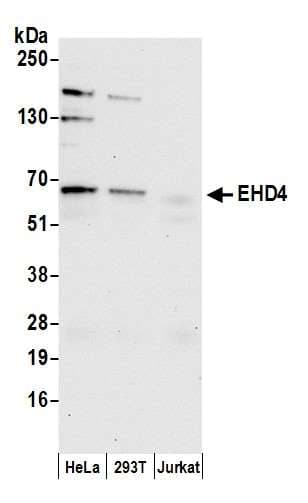 Polyclonal Rabbit anti-Human EHD4 Antibody (aa375-425, WB)