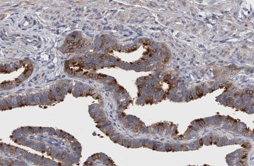 Polyclonal Rabbit anti-Human ITGB3 / Integrin Beta 3 / CD61 Antibody (phospho-Tyr773, IHC, IF, WB)
