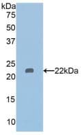 HDAC6 Antibody (aa166-348)