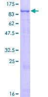Human MCCC1 Protein (Recombinant GST)