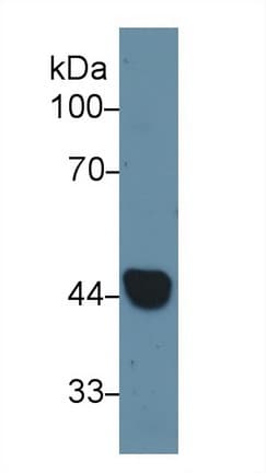 KRT19 / CK19 / Cytokeratin 19 Antibody (aa83-390)