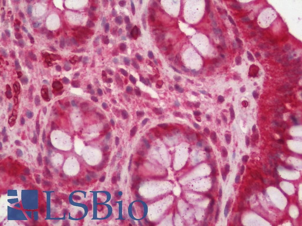 IHC-plus™ Polyclonal Rabbit anti-Human WWC1 / KIBRA Antibody (IHC, IF, WB)