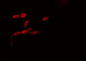 HSPA8 / HSC70 Antibody