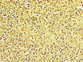 LYZ / Lysozyme Antibody (aa19-148)
