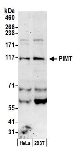 Trimethylguanosine Synthase 1 Antibody (aa803-853)