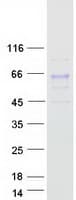 Human GALNT2 Protein (Recombinant Myc-DDK (Flag))