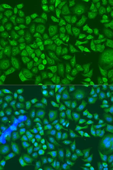 Polyclonal Rabbit anti-Human IGF2BP2 Antibody (IF, WB)