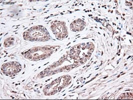 TRIM33 / TIF1-Gamma Antibody (clone OTI9D4)