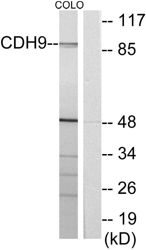 Polyclonal Rabbit anti-Human CDH9 / Cadherin 9 Antibody (IHC, IF, WB)