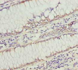 SOCS4 Antibody