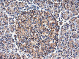 TUBAL3 Antibody (aa150-446, clone OTI1G6, Carrier-free)