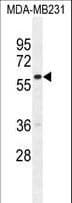 GNL3L Antibody (aa102-130)