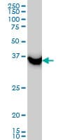 IHC-plus™ SAE1 Antibody (clone 1G4-1G5)