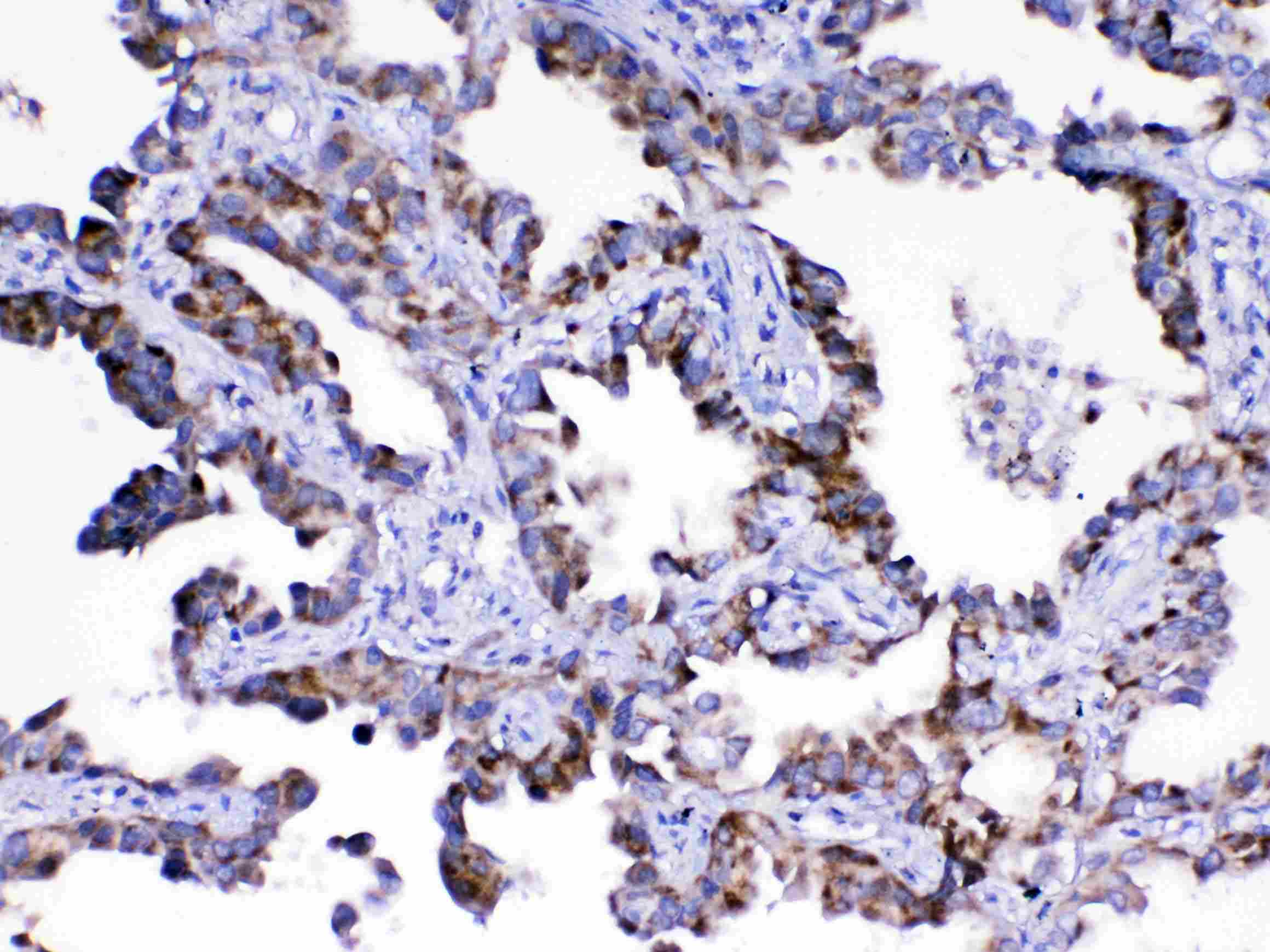 ASL / Argininosuccinate Lyase Antibody