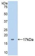 SERPING1 / C1 Inhibitor Antibody (aa399-500)