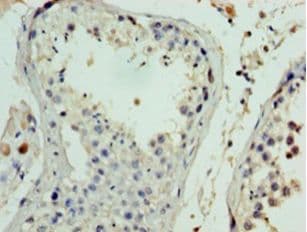FANK1 Antibody (aa1-345)