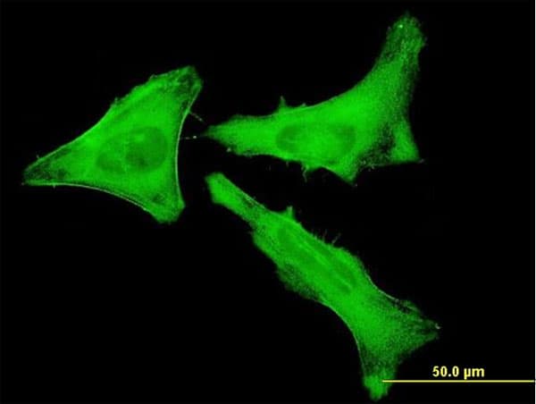 IHC-plus™ MYH9 Antibody (clone 2B3)