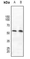 RORC / ROR Gamma Antibody