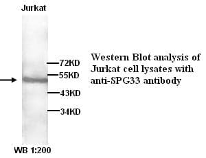 ZFYVE27 / Protrudin Antibody