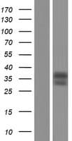 NR1I3 / CAR Protein (Over-Expression Lysate Myc-DDK (Flag))