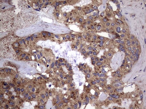 IL1RN Antibody (clone OTI2B1)