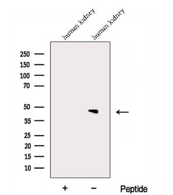 Dipeptidase 2 / DPEP2 Antibody