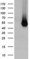 HP / Haptoglobin Antibody (clone OTI1B1)
