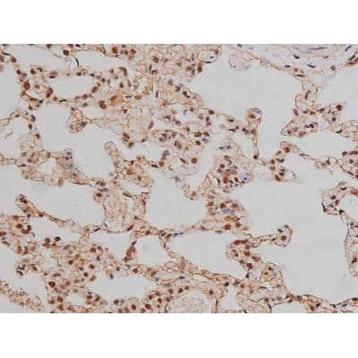 SP1 Antibody (phospho-Thr453)