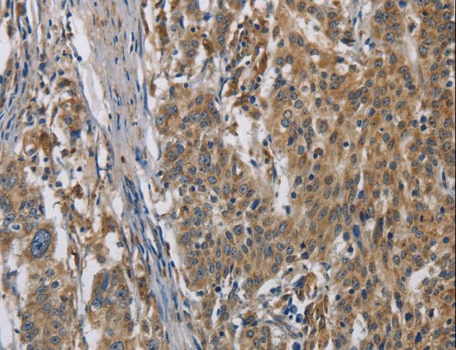 OPRS1 / SIGMAR1 Antibody