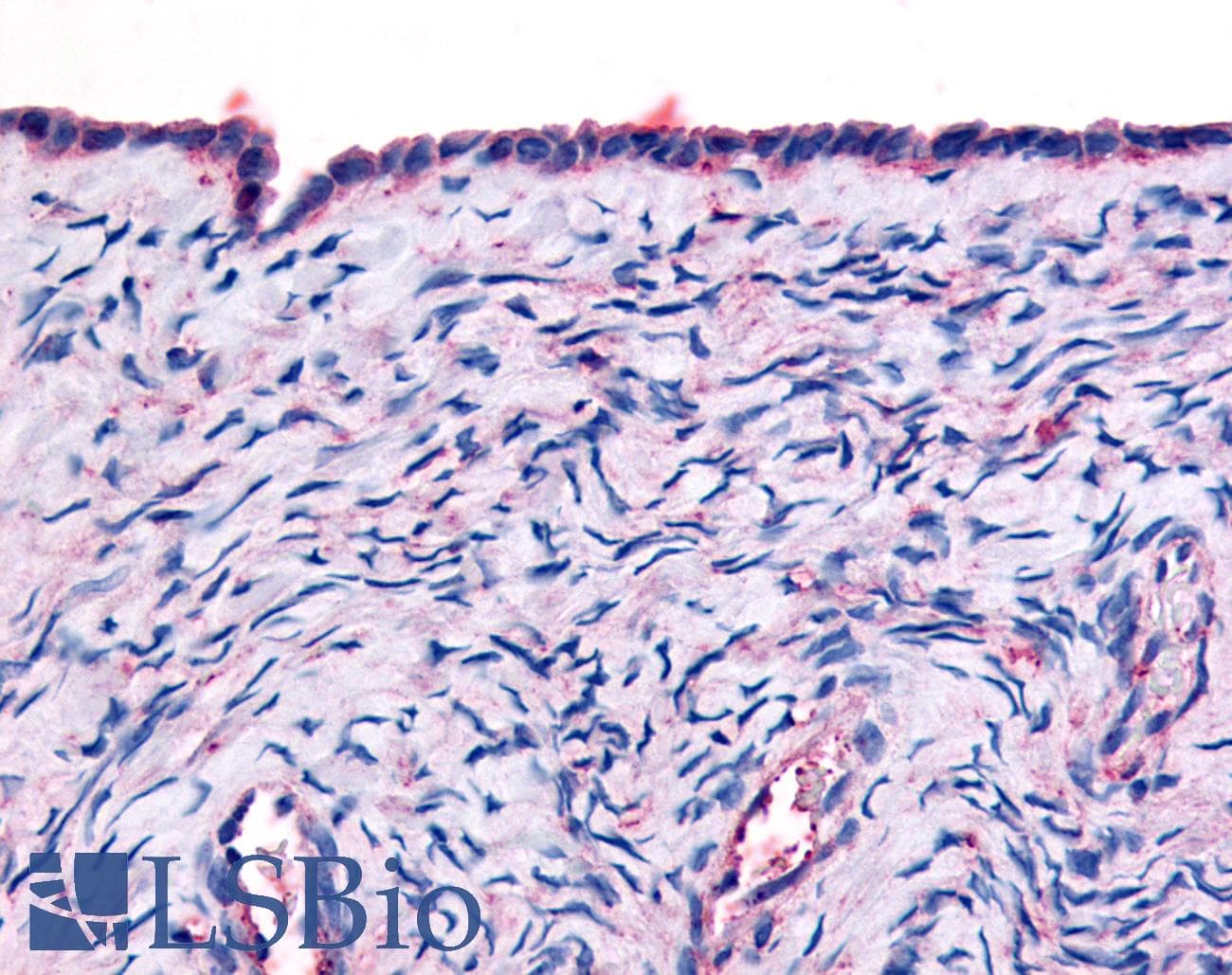 IHC-plus™ THRA / THR Alpha Antibody (Ligand-binding Domain)
