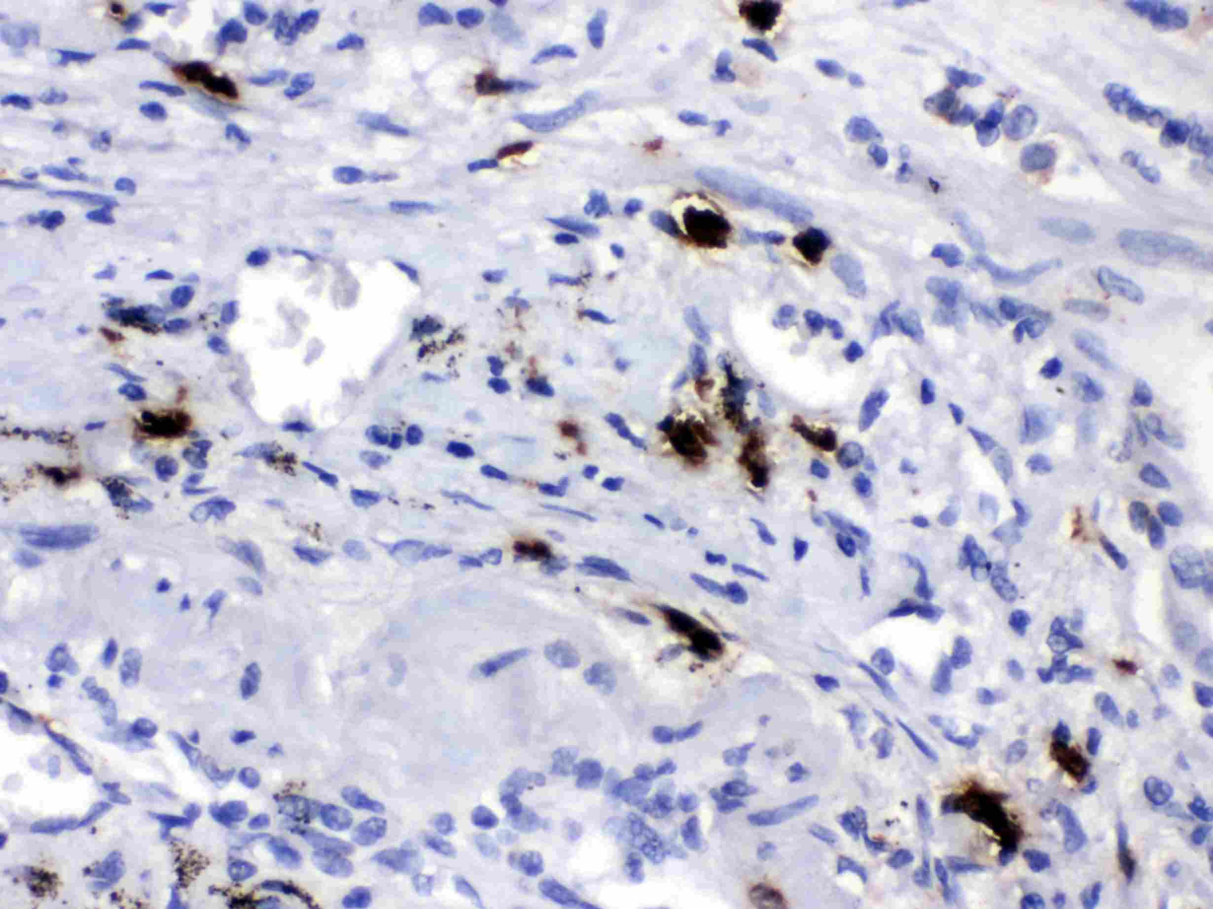 CPB2 / TAFI Antibody
