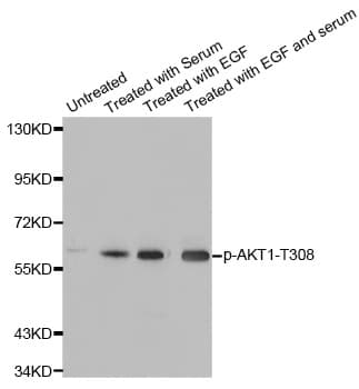 Polyclonal Rabbit anti-Human AKT1 Antibody (phospho-Thr308, WB)
