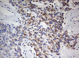 ZEB1 / AREB6 Antibody (aa1-350, clone OTI7E12)