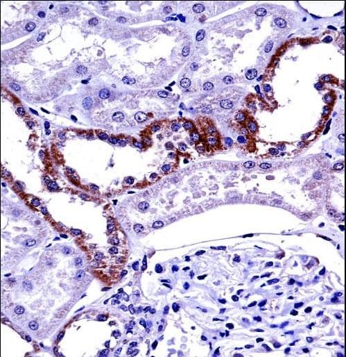 MCOLN1 / Mucolipin 1 Antibody (aa531-560)