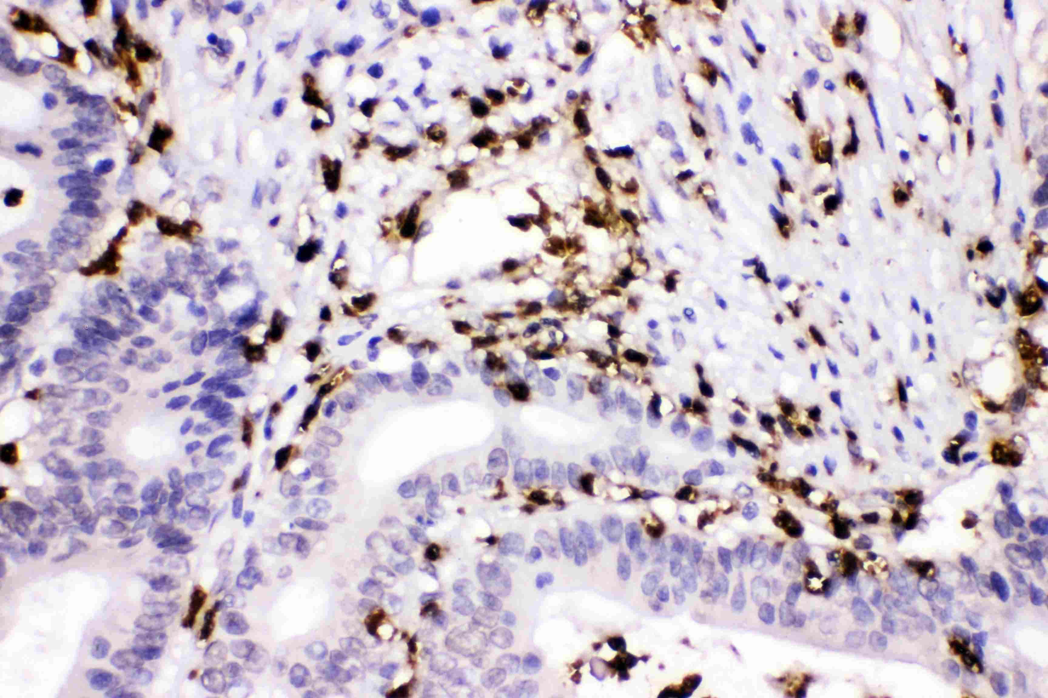 Polyclonal Rabbit anti-Human CTSG / Cathepsin G Antibody (IHC, WB)
