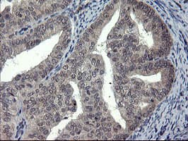 DOK7 Antibody (clone OTI7E2)